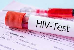 مهم‌ترین چالش امروز HIV در ایران