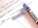 الگوی انتقال ویروس HIV تغییر کرده/ کنترل این بیماری رایگان است؟